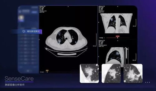 AI战疫 人工智能在疫情防控中的软件开发与应用